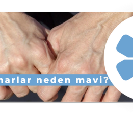 Damarlar neden mavi?